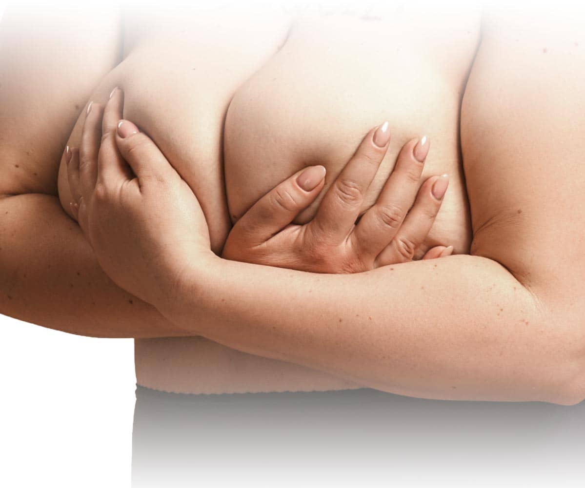 Breast Reduction Surgery